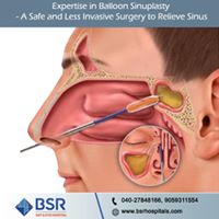 sinus_surgery_in_Hyderabad